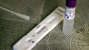Testkassette eines Corona-Schnelltests (Antigentest) (Foto: picture alliance/dpa | Karl-Josef Hildenbrand)