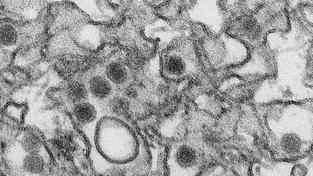 Das Zika-Virus (Blick durch ein Elektronenmikroskop) (Foto: picture alliance / dpa / Cynthia Goldsmith)